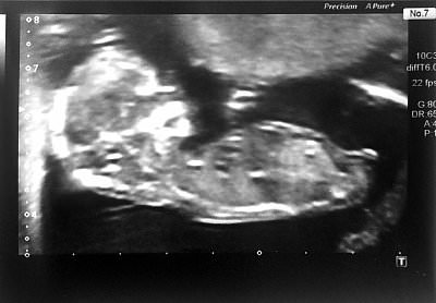 BabyScan.jpg